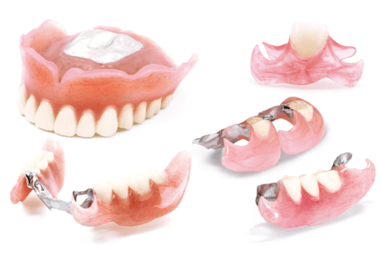 入れ歯の種類を豊富に取り揃えています。